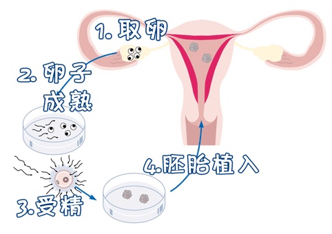 好孕案例